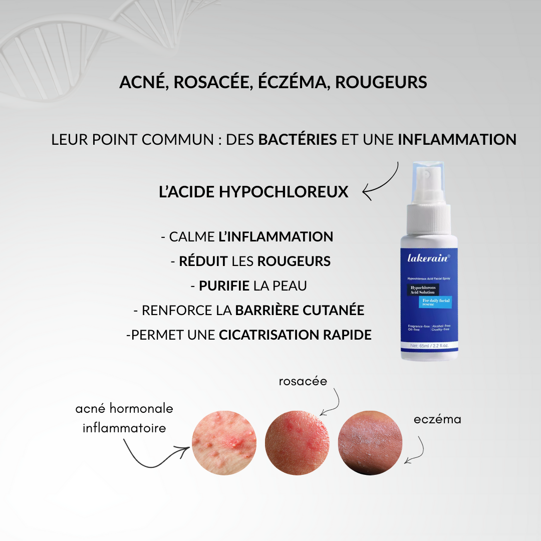 L'Acide Hypochloreux, une peau enfin nette