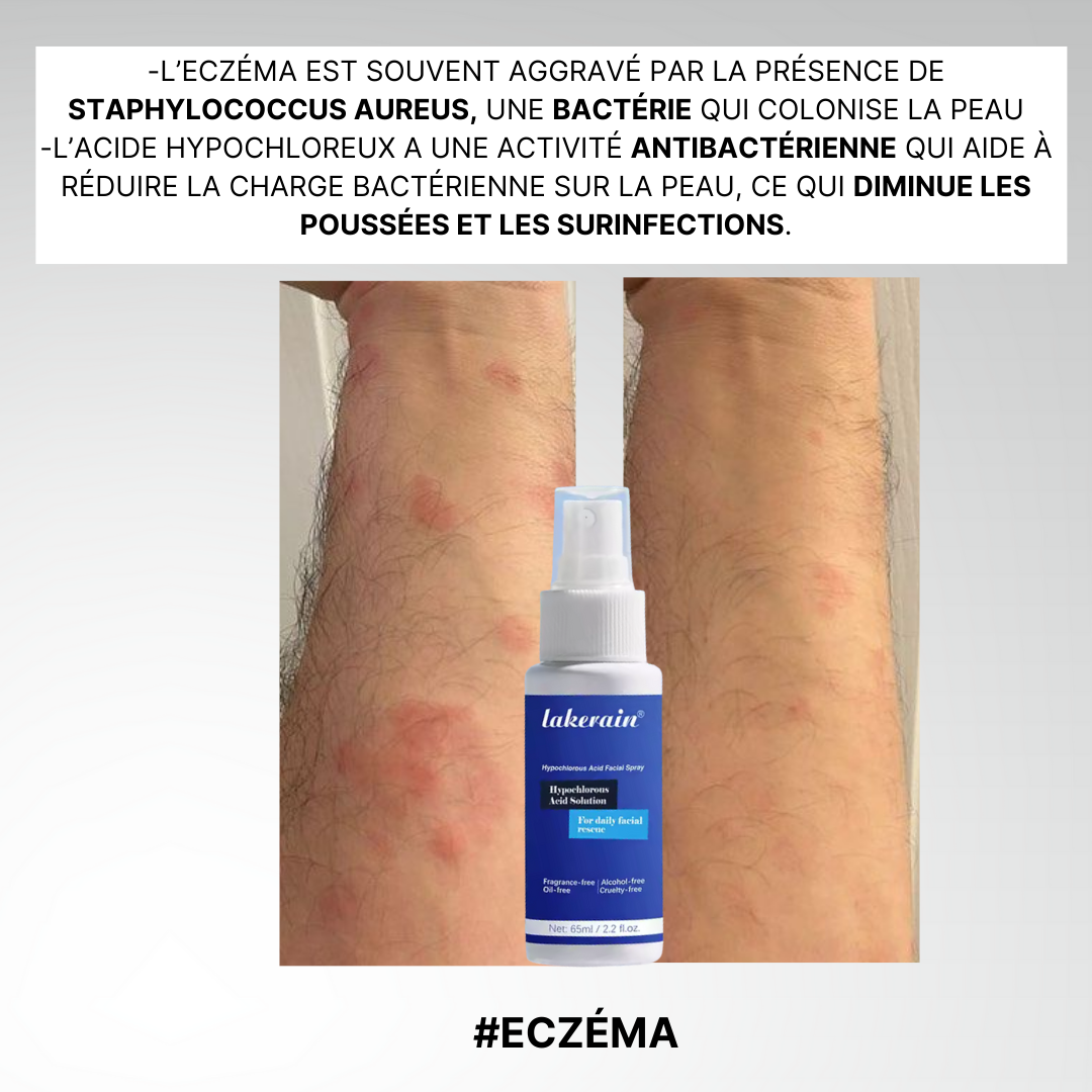 L'Acide Hypochloreux, une peau enfin nette